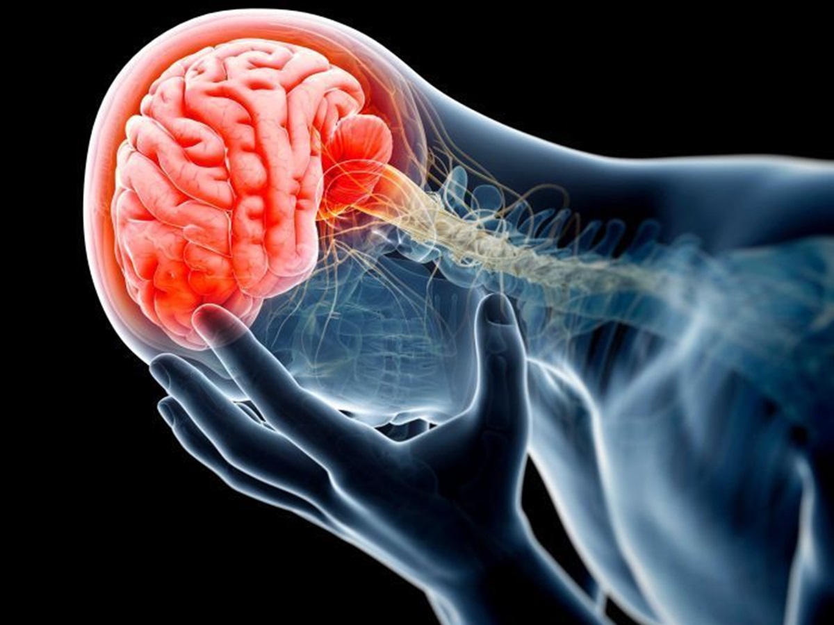 Symptoms of Arteriovenous Malformation(AVM)?