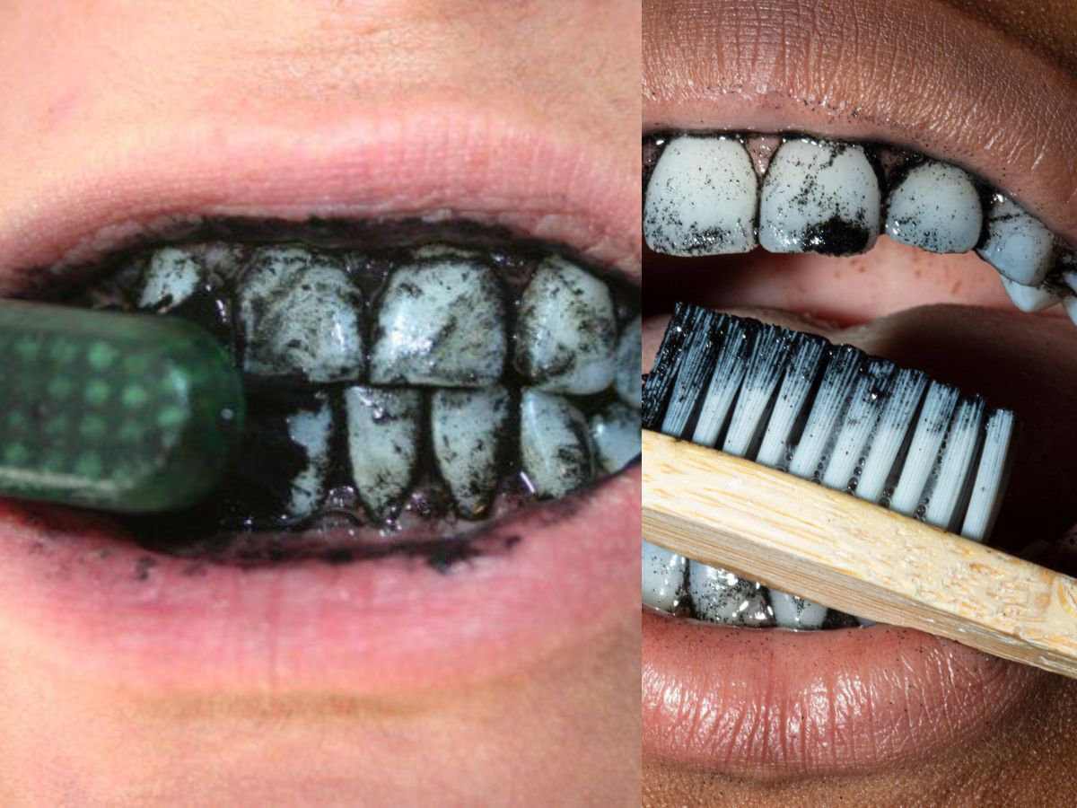 Brushing with activated charcoal