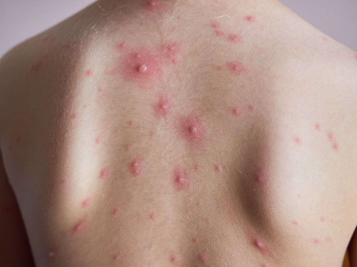 Soft Grains (Porridge, Khichdi, Oatmeal)