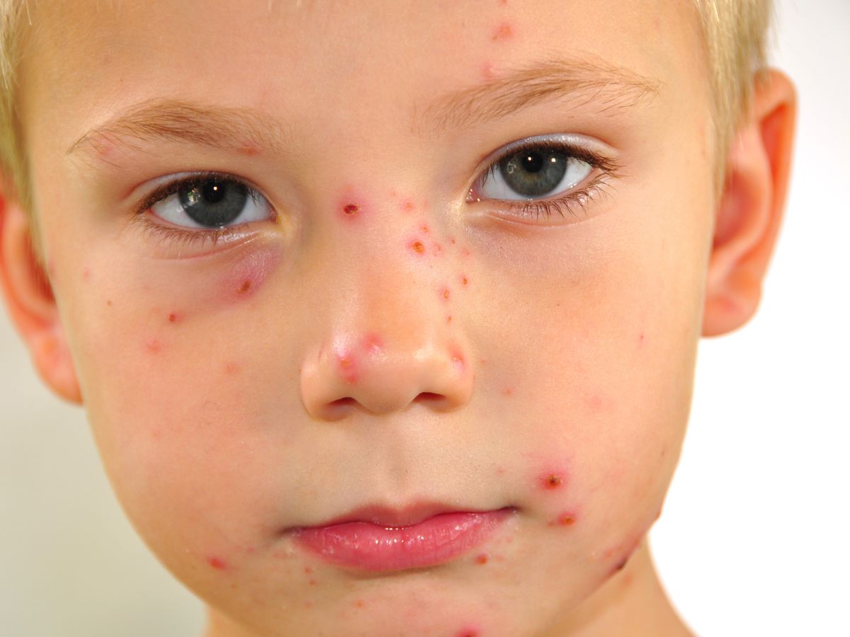 Foods That Hydrate (Coconut Water, Water-Rich Fruits)