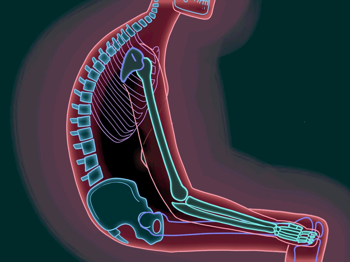 Wearing Unsupportive Shoes