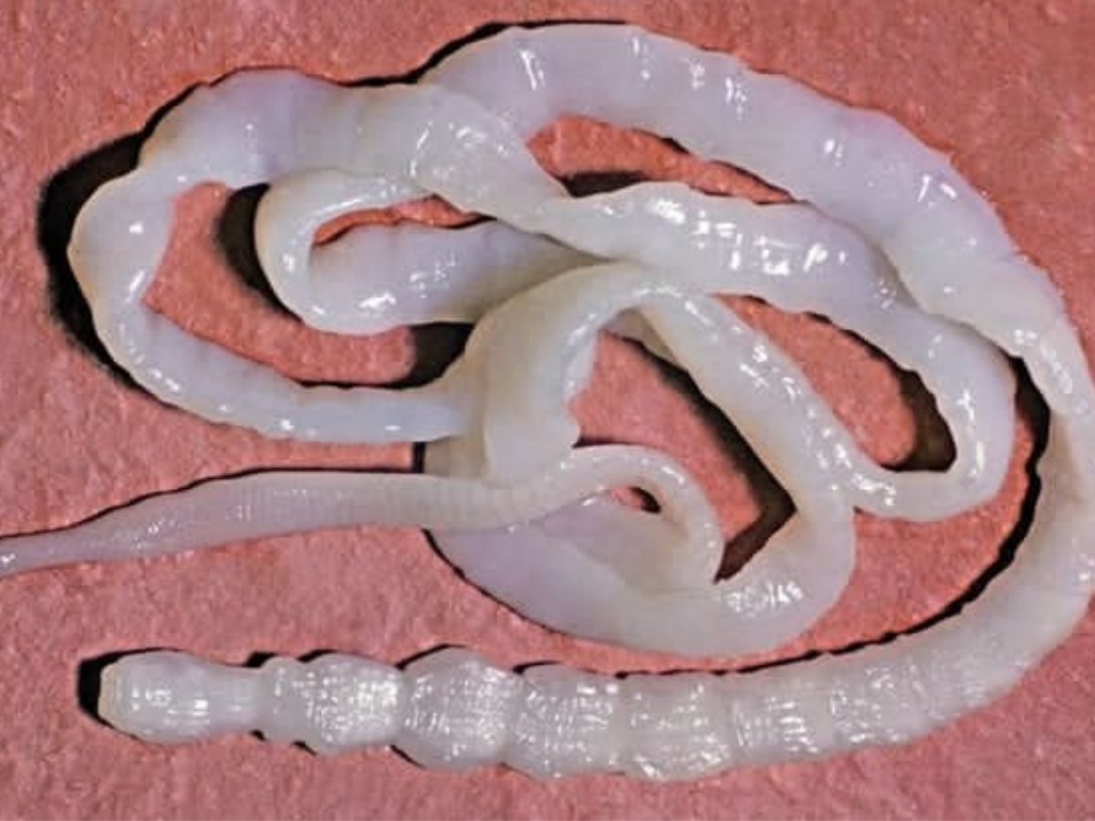 Tapeworms