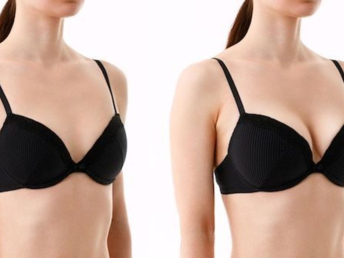 No Boob Is “Perfect” – Just Perfectly Yours