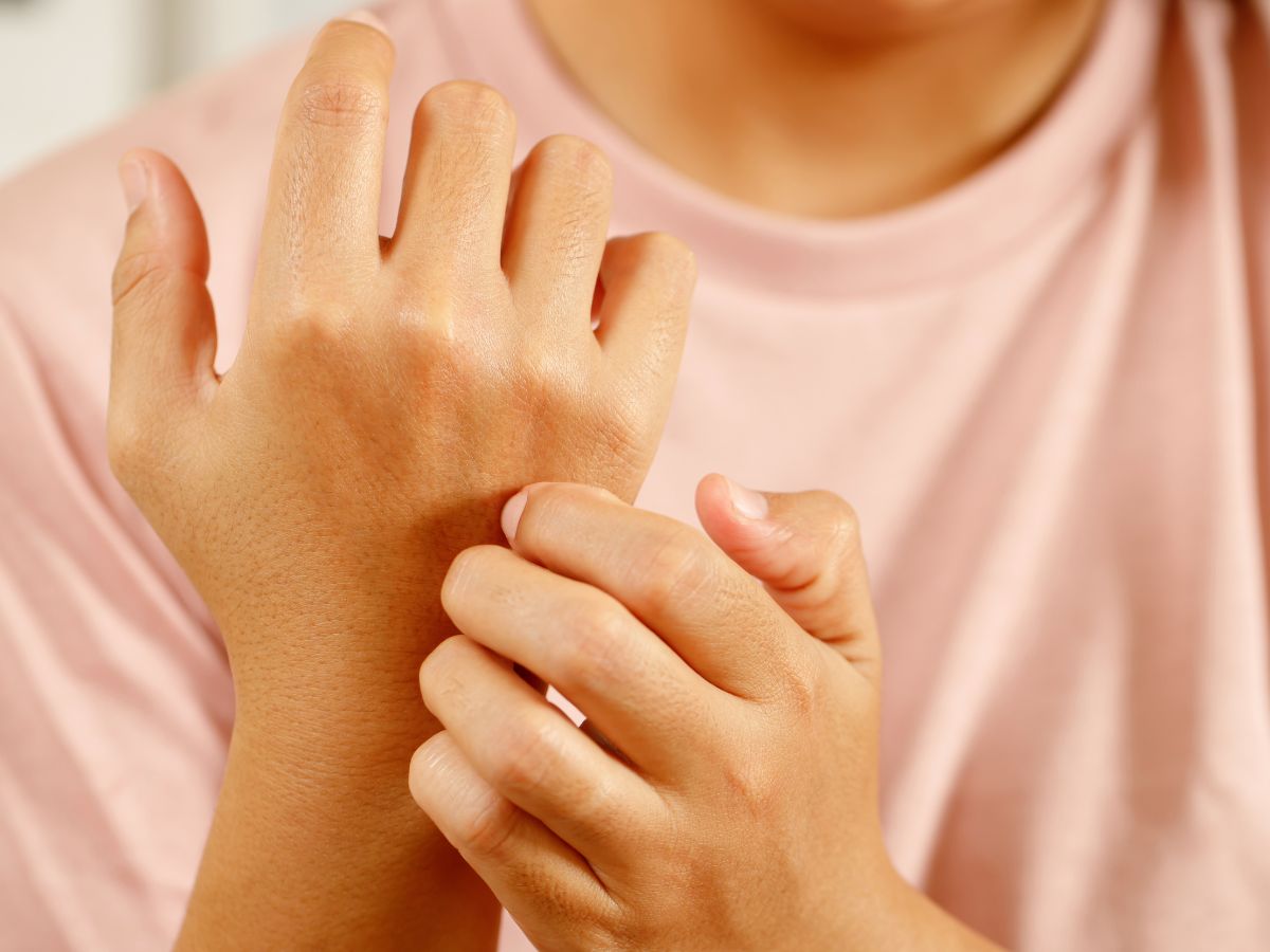 Itchy Skin (Pruritus)