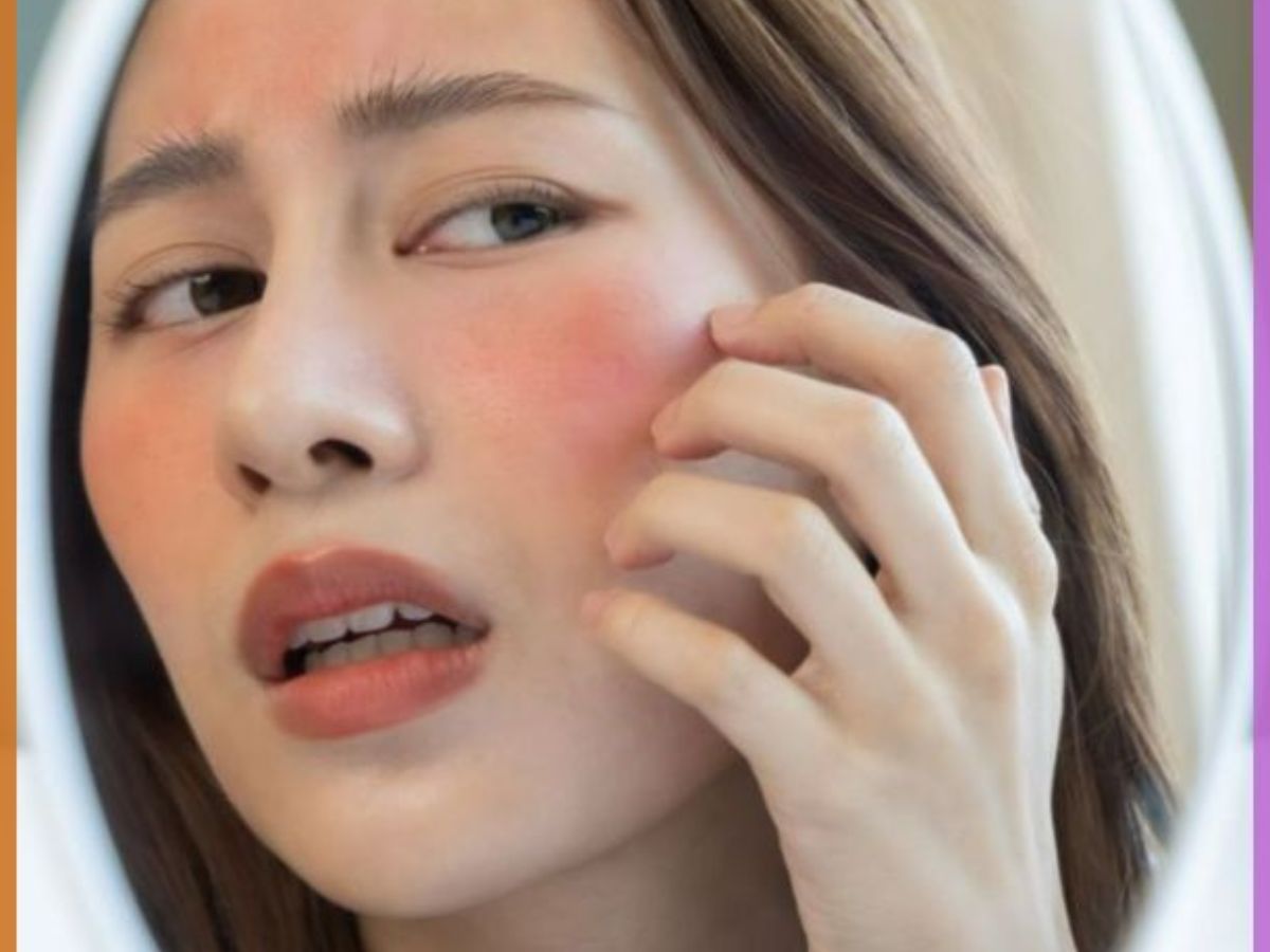 Irritated Skin & Breakouts