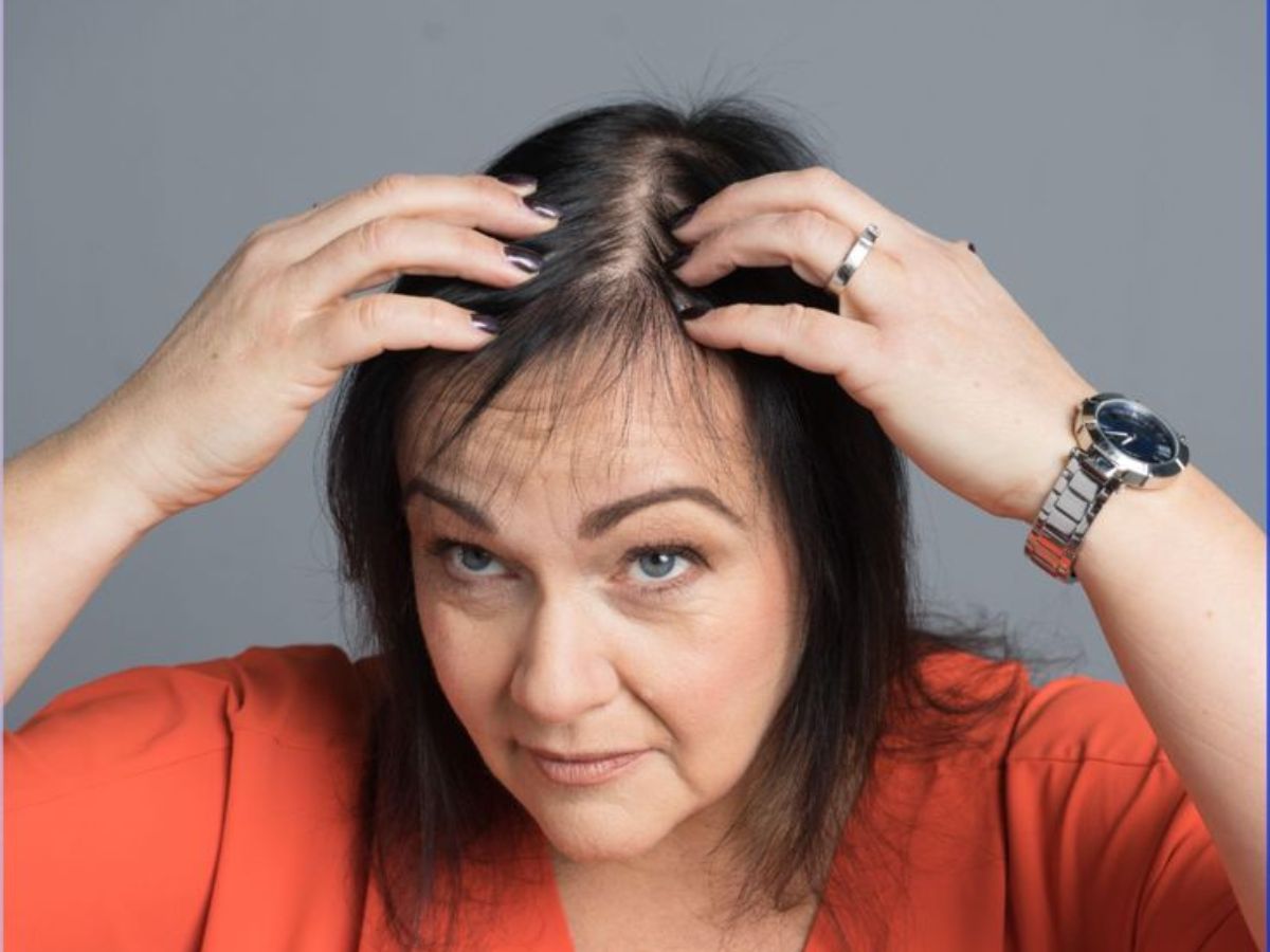 Hair Thinning or Hair Loss