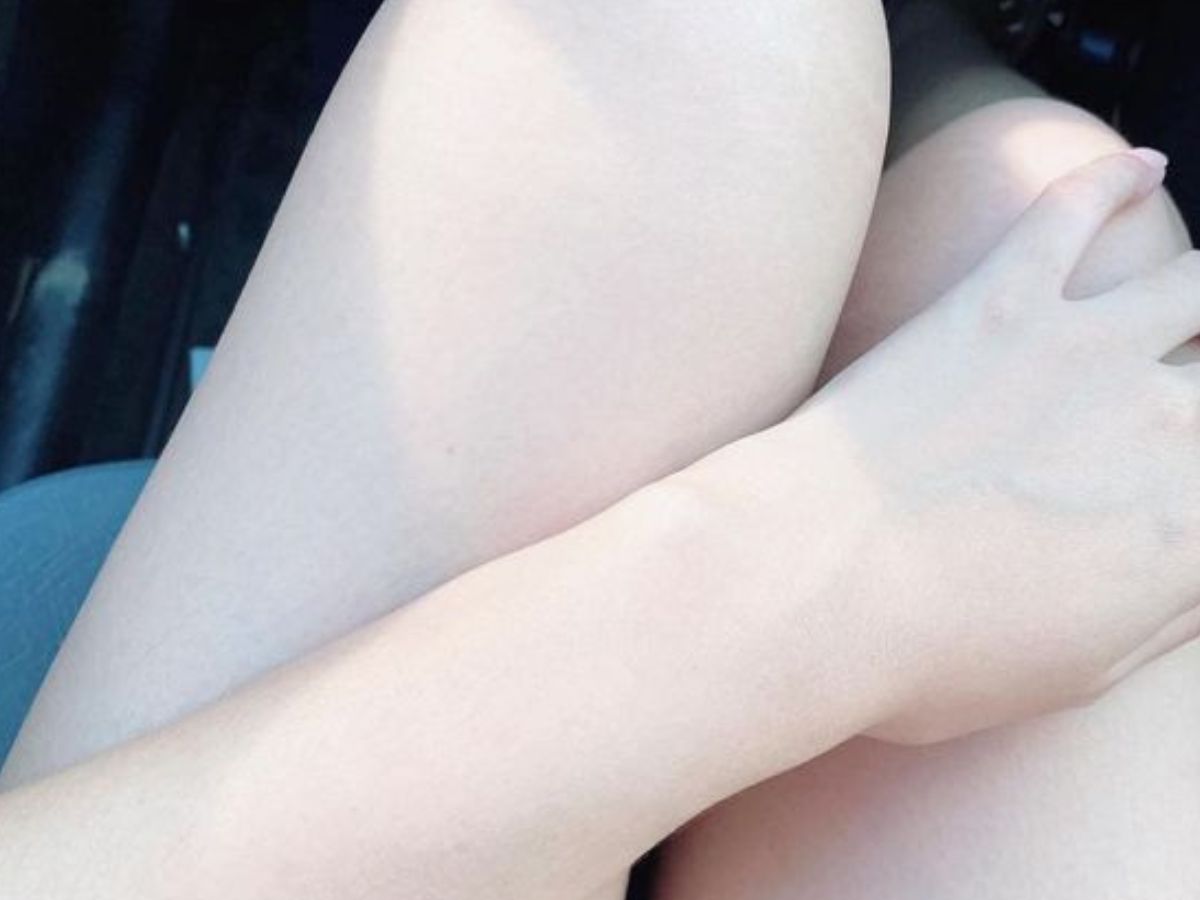 Pale or Yellowish Skin