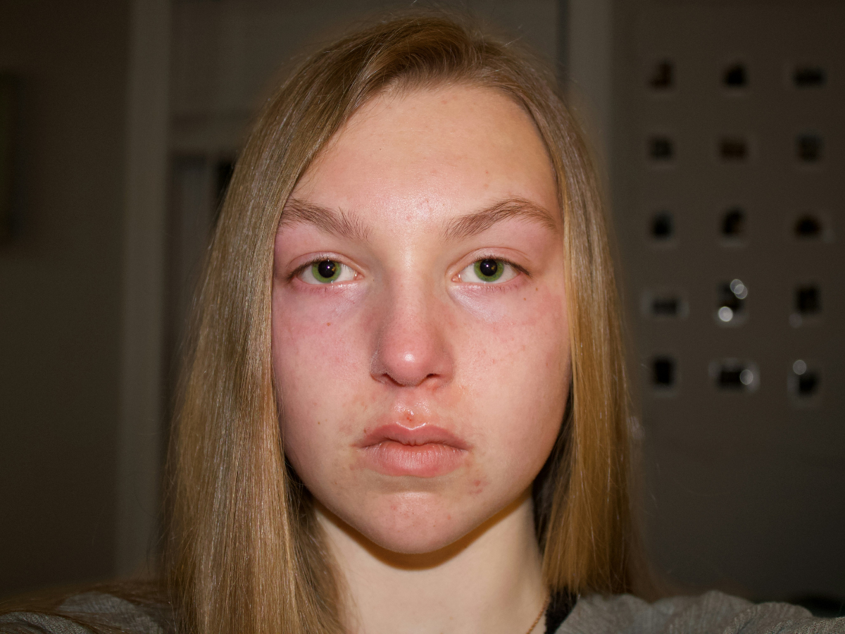 Tingling Doesn’t Mean It’s Working