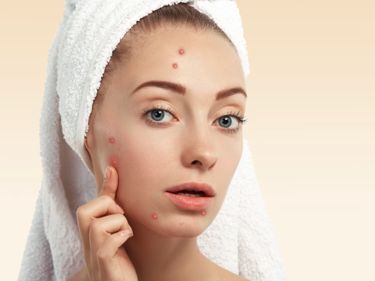 Same Skin Issues, Different Solutions