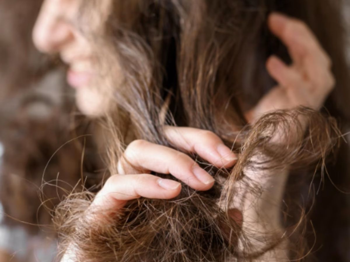 Hair Thinning or Hair Loss