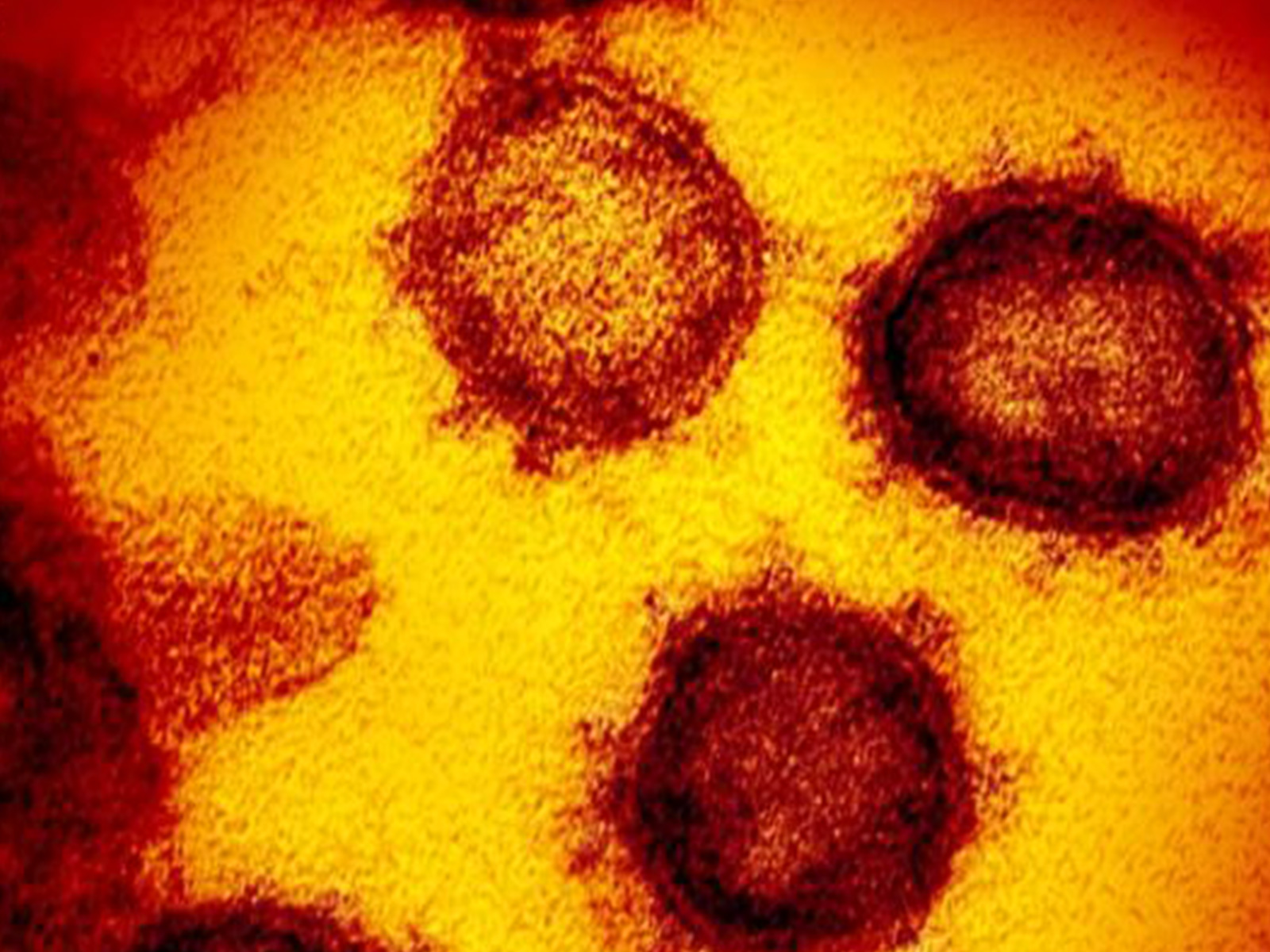 The shield before the arrow: Researchers unveil AI-driven 'Universal Vaccine' to pre-empt next pandemic